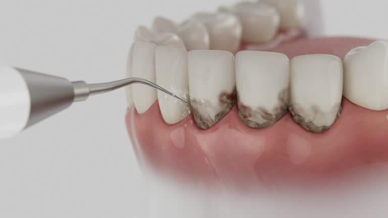 Trusted Root Canal Treatment service in Hornsby Bend, TX - Dentist Open Now